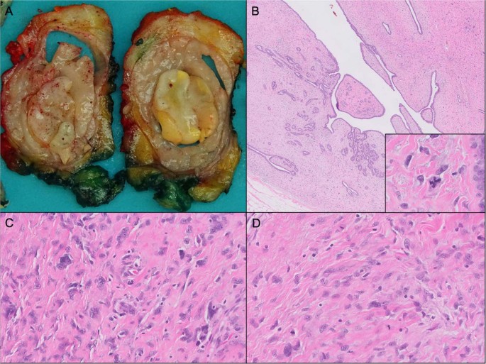 figure 17