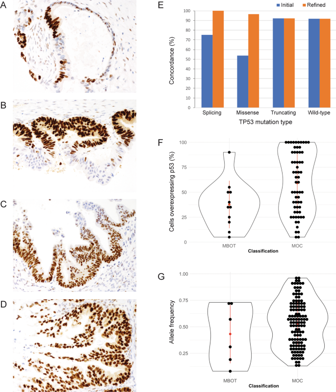 Fig. 2: TP53 immunohistochemistry and TP53 mutations by sequencing in ovarian mucinous tumors.