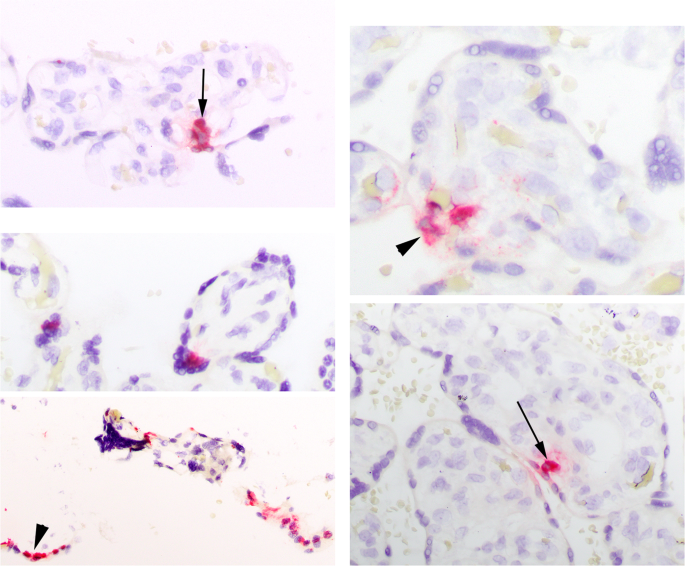 Fig. 4: Viral expression via ISH in MGH4.