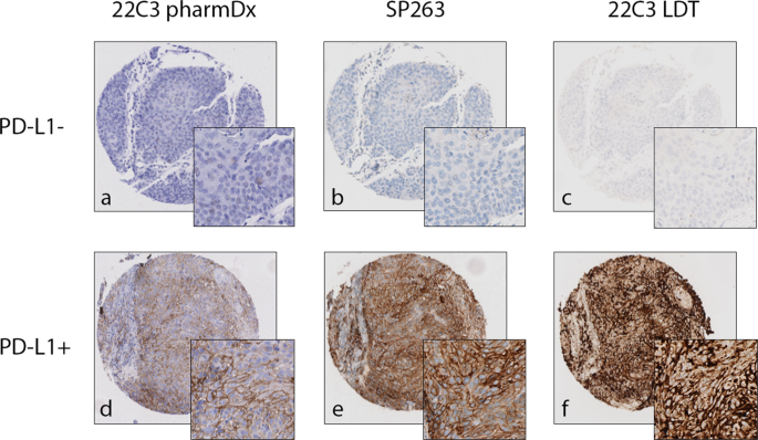 Fig. 2: Representative images of TMA cores.