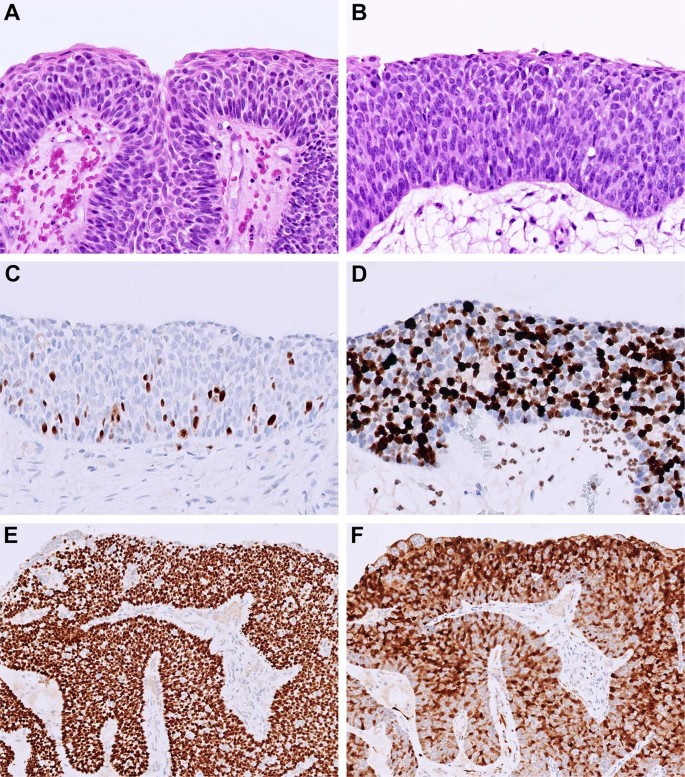 Fig. 5: Tumor cell proliferation and immunohistochemistry.