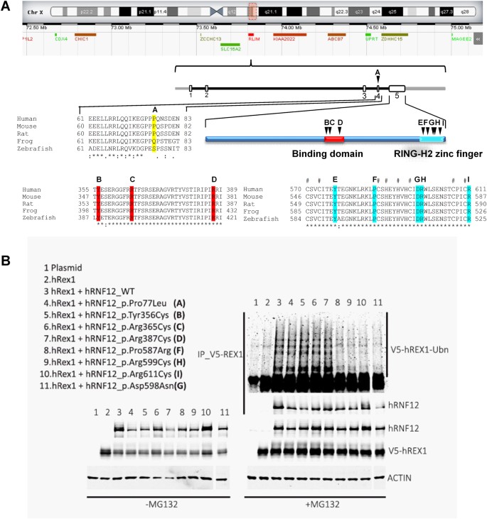 Pathogenic Variants In E3 Ubiquitin Ligase Rlim Rnf12 Lead To A Syndromic X Linked Intellectual Disability And Behavior Disorder Molecular Psychiatry