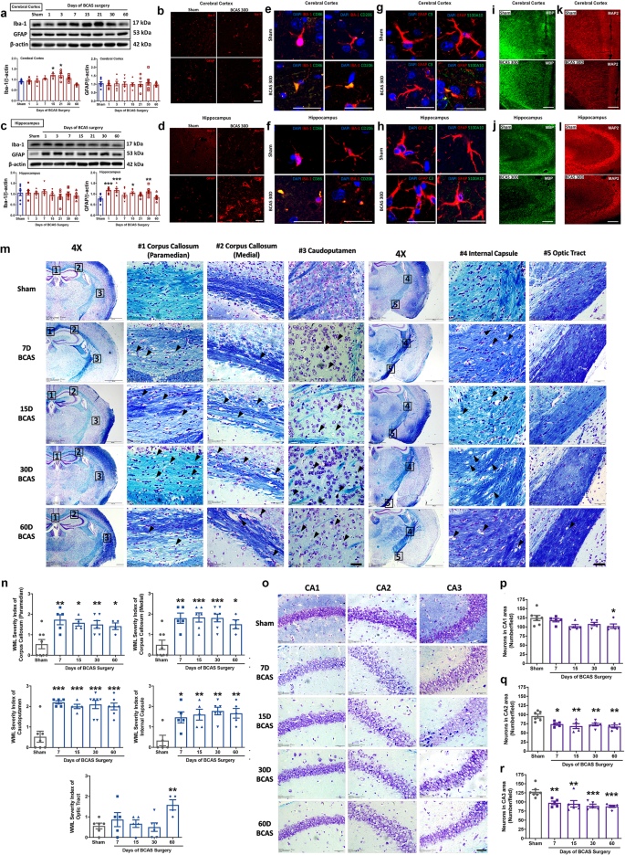 Aim2 Inflammasome Mediates Hallmark Neuropathological Alterations And Cognitive Impairment In A Mouse Model Of Vascular Dementia Molecular Psychiatry