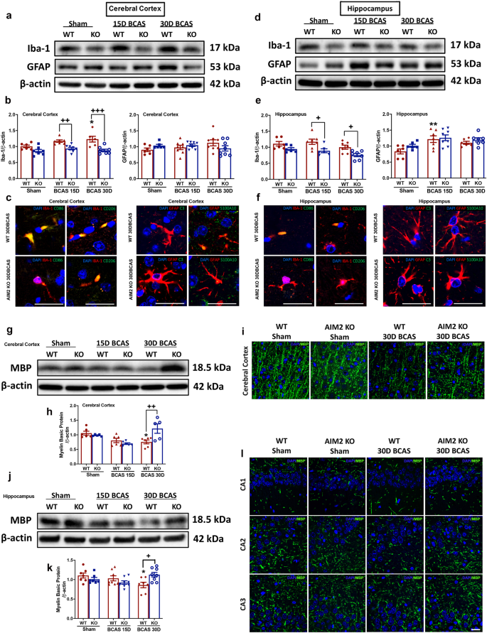 Aim2 Inflammasome Mediates Hallmark Neuropathological Alterations And Cognitive Impairment In A Mouse Model Of Vascular Dementia Molecular Psychiatry