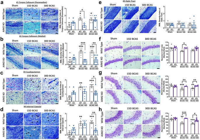 Aim2 Inflammasome Mediates Hallmark Neuropathological Alterations And Cognitive Impairment In A Mouse Model Of Vascular Dementia Molecular Psychiatry