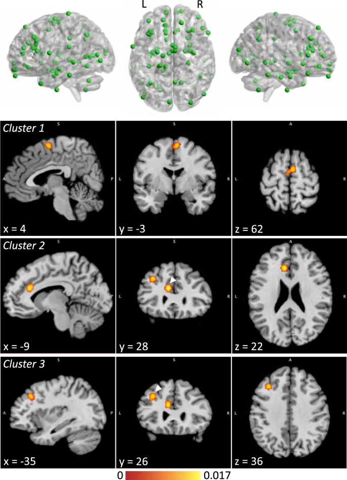 8-185 gray vs. white matter in the CNS Diagram