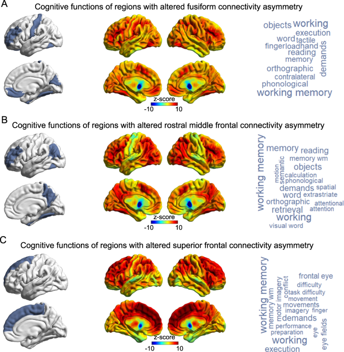 Large-scale analysis of structural brain asymmetries in schizophrenia via  the ENIGMA consortium
