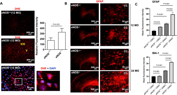 Frontiers  Striatal fibrinogen extravasation and vascular degeneration  correlate with motor dysfunction in an aging mouse model of Alzheimer's  disease