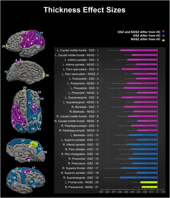 Cortical morphology in patients with the deficit and non-deficit