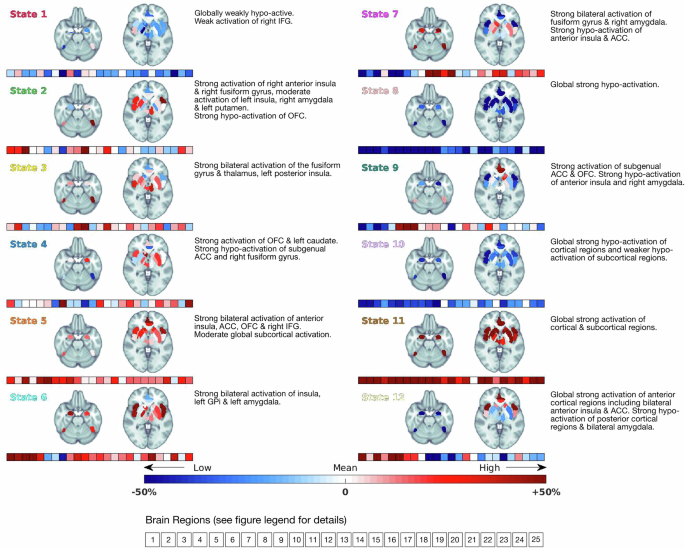Fig. 3: Brain states.