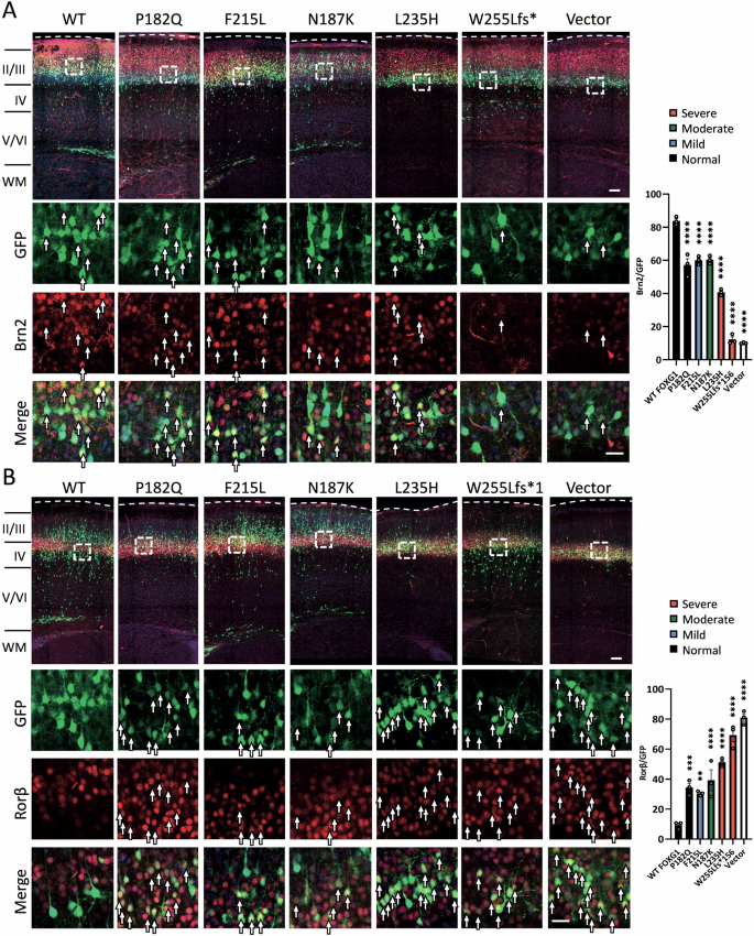 Fig. 4: Effects of the expression of FOXG1 and its variants on the expression of the layer II/III and IV neuronal markers in the developing cortex.