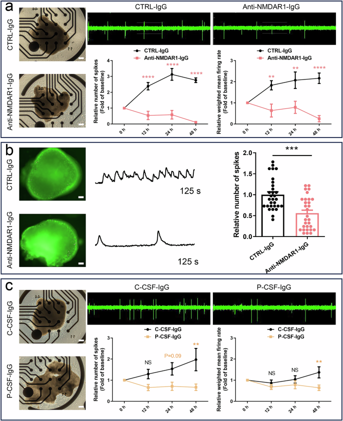 Fig. 4: NMDAR1-Ab exposure causes hypo neuroactivities in hFOs.