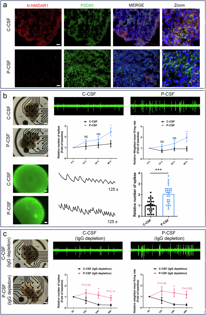 Fig. 5: NMDARE patient CSF and IgG-depleted patient CSF cause hyper neuroactivities in hFOs.