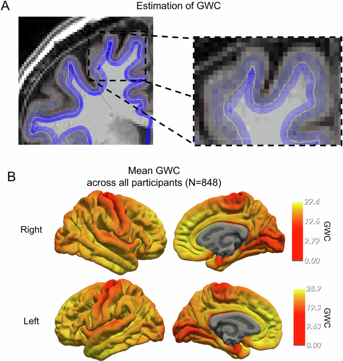 Fig. 1: Estimation of GWC.