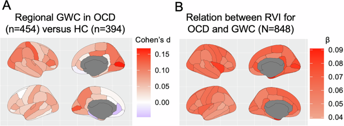Fig. 3: GWC in OCD.