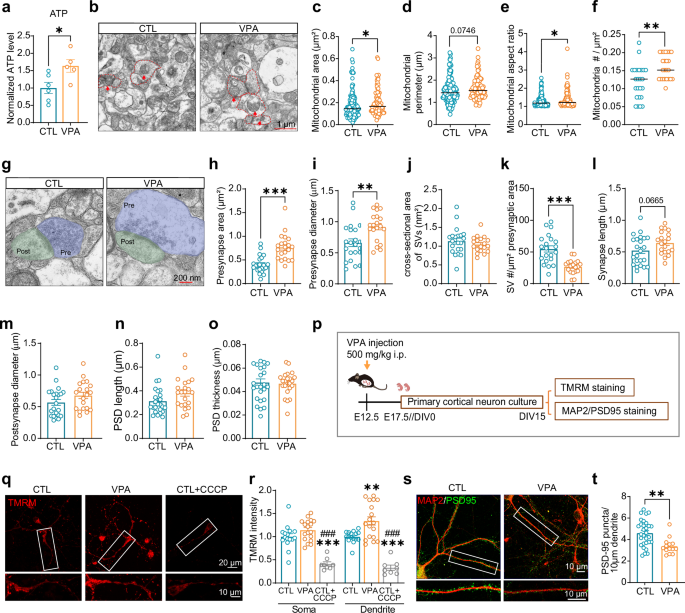 Fig. 3: VPA mice exhibit altered mitochondrial and synaptic morphology in the cerebral cortex.