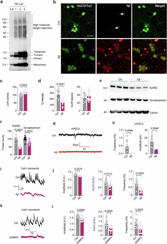 Fig. 2: Aβ impairs the connectivity and activity of enteric neurons.