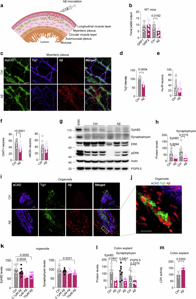 Fig. 3: Aβ affects ENS connectivity and GI function in mouse and human models.