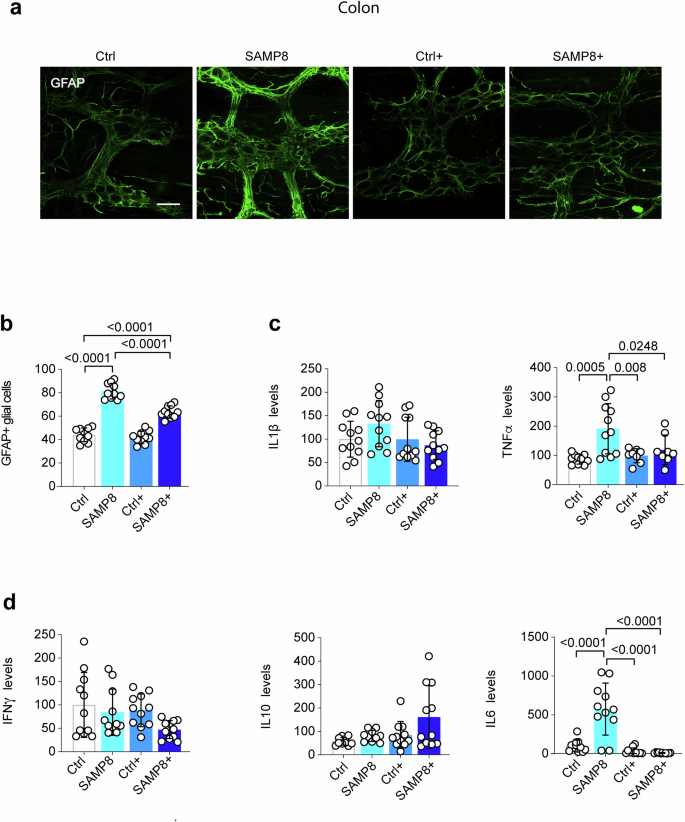 Fig. 6: Butyrate reduces gut neuroinflammation in SAMP8 mice.