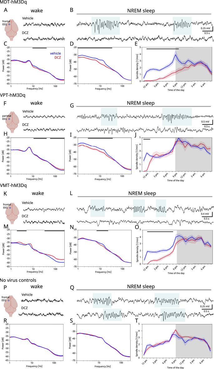 Fig. 2: Chemogenetic activation of thalamus alters spontaneous oscillatory activity.
