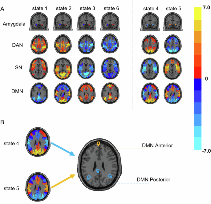 Fig. 3: Spatial organization of co-activation pattern (CAP) states.