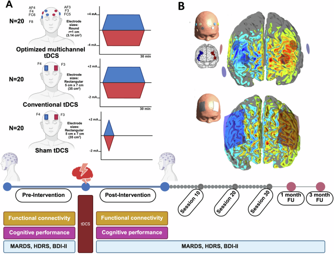 Fig. 1: Study design, tDCS montages and E‑field distribution.