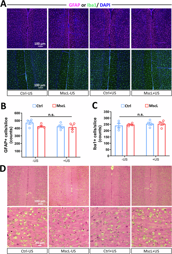 Fig. 5: Sonogenetic modulation is safe at the cellular and tissue levels.