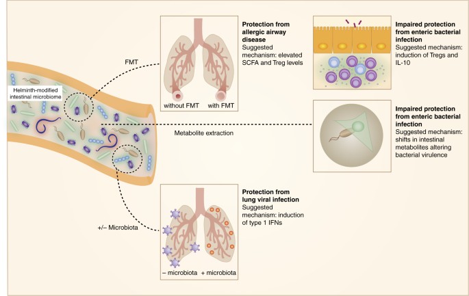 su helminthiasis esetén