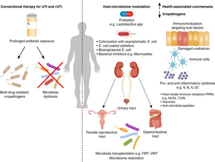 urinary dysbiosis papilom intraductal trebuie operat