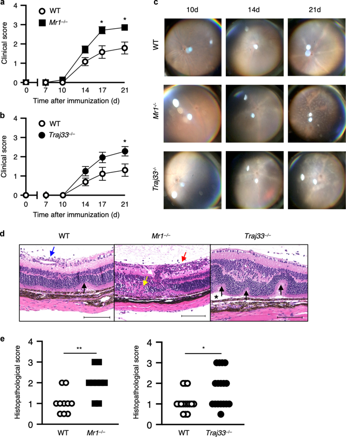 Fig. 2: MAIT cell deficiency accelerates uveitis in mice.