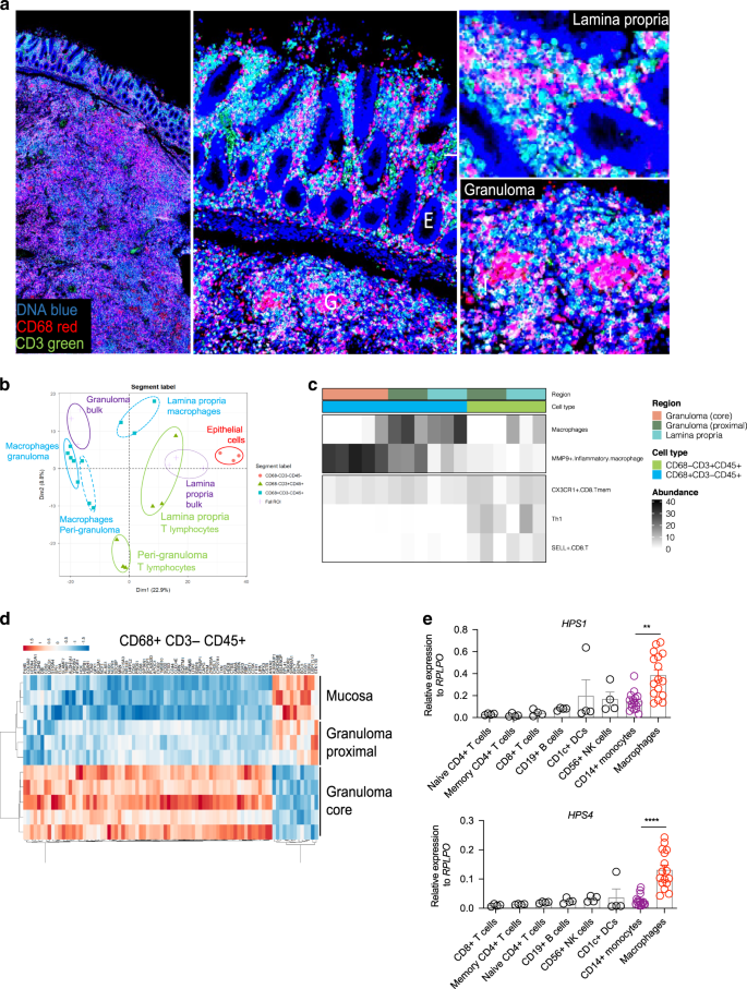 Impaired Autophagy in the Lipid-Storage Disorder Niemann-Pick Type C1  Disease - ScienceDirect