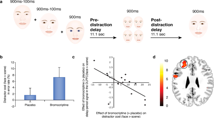 Fig. 7: Effects of the DA D2 receptor agonist on delay activity after distraction in healthy volunteers.