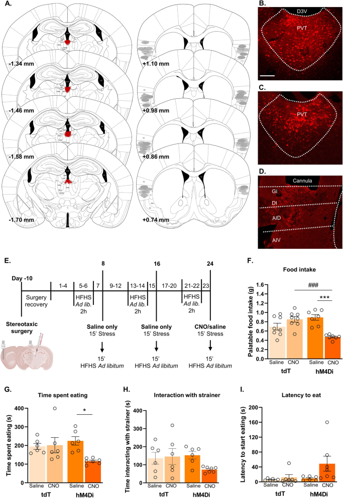 Fig. 4: Inhibition of PVTVglut2+-insular cortex projections attenuates stress-induced binge eating.