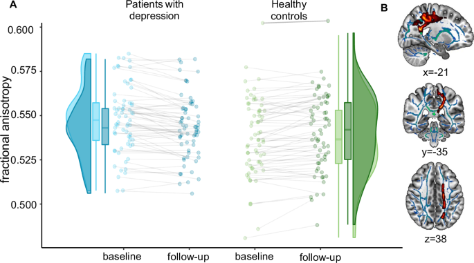Fig. 1: Longitudinal group differences in fractional anisotropy.