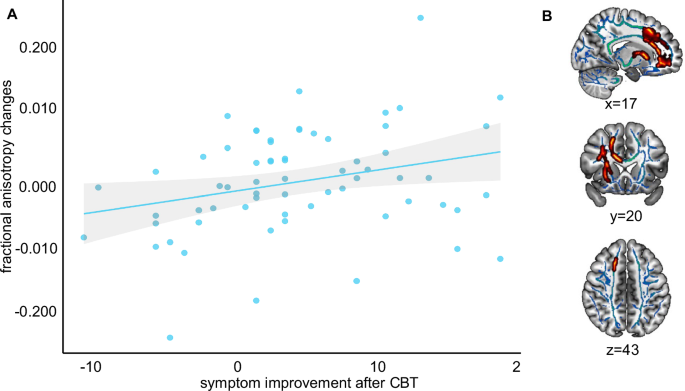 Fig. 2: Longitudinal association between depressive symptom changes and fractional anisotropy changes in patients with depression.
