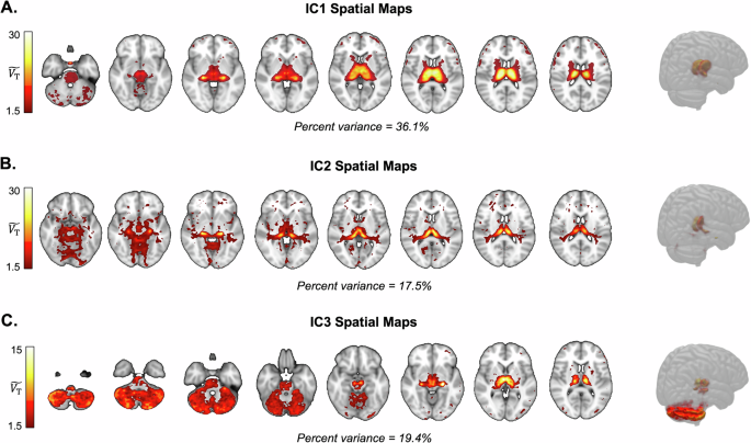 Fig. 1: Spatial maps of independent components (IC) derived from ICA across [18F]Flubatine PET baseline scans of non-smokers (n = 26).