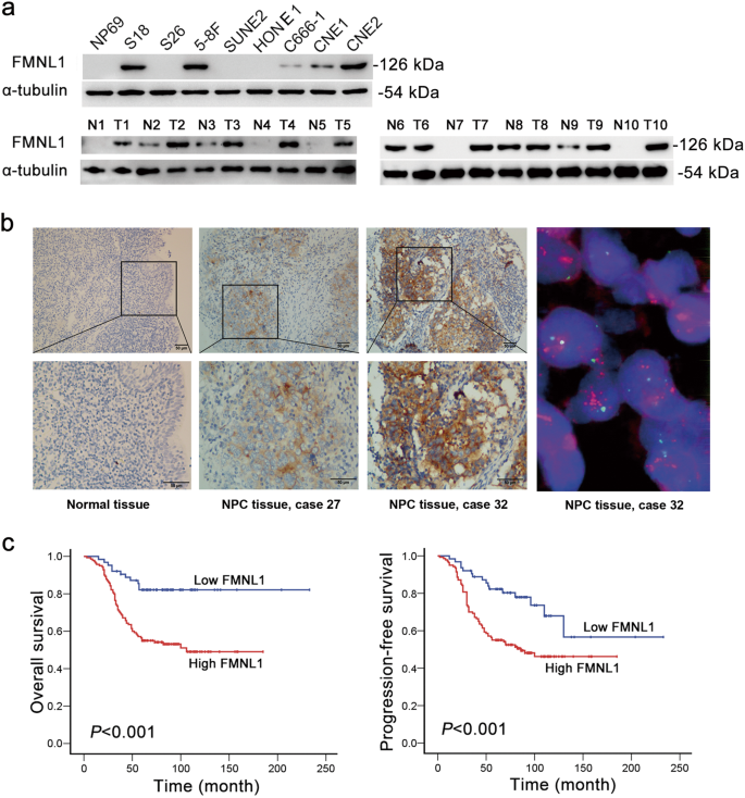 FMNL1 mediates nasopharyngeal carcinoma cell aggressiveness by  epigenetically upregulating MTA1 | Oncogene