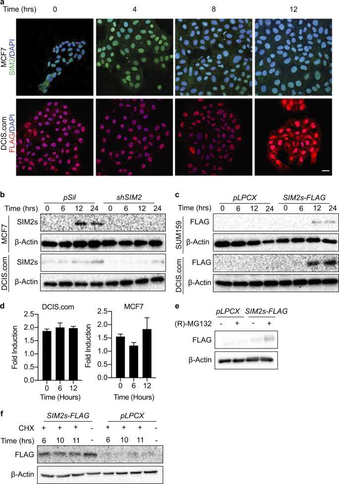 atm dependent activation of sim2s regulates homologous recombination and epithelial mesenchymal transition oncogene