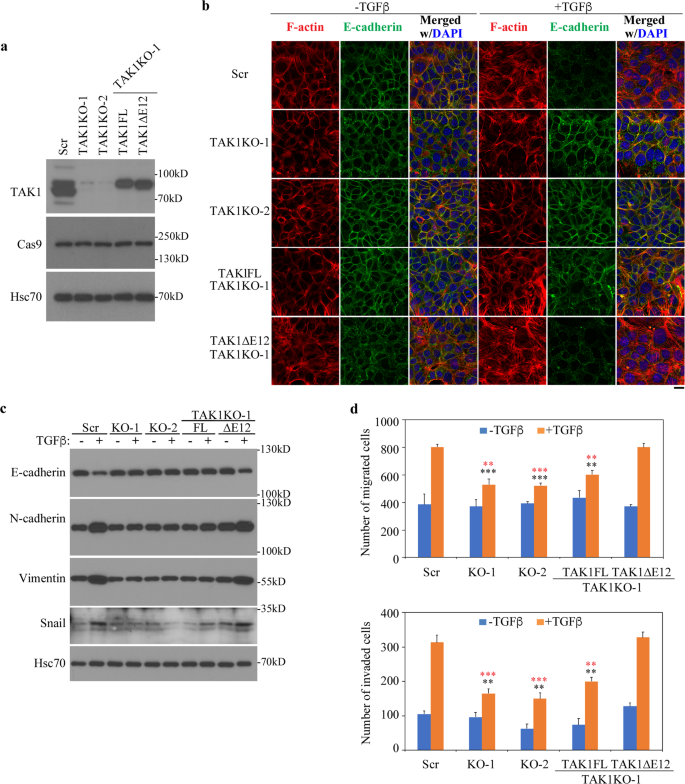Tgf B Induced Alternative Splicing Of Tak1 Promotes Emt And Drug Resistance Oncogene