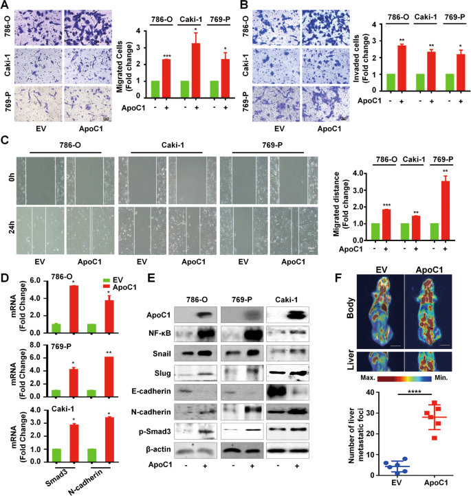 apoc1 promotes the metastasis of clear cell renal cell carcinoma via activation of stat3 oncogene cell renal cell carcinoma