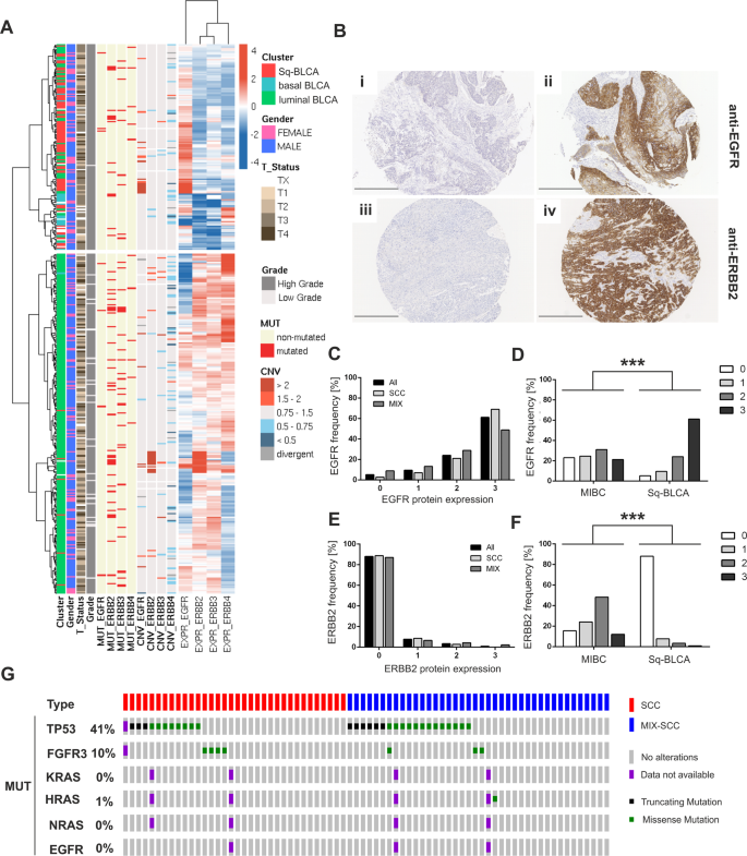 Egfr Activity Addiction Facilitates Anti Erbb Based Combination Treatment Of Squamous Bladder Cancer Oncogene