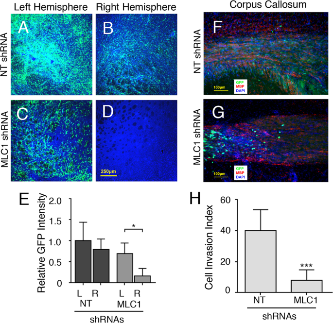 Megalencephalic Leukoencephalopathy With Subcortical Cysts 1 Mlc1 Promotes Glioblastoma Cell Invasion In The Brain Microenvironment Oncogene