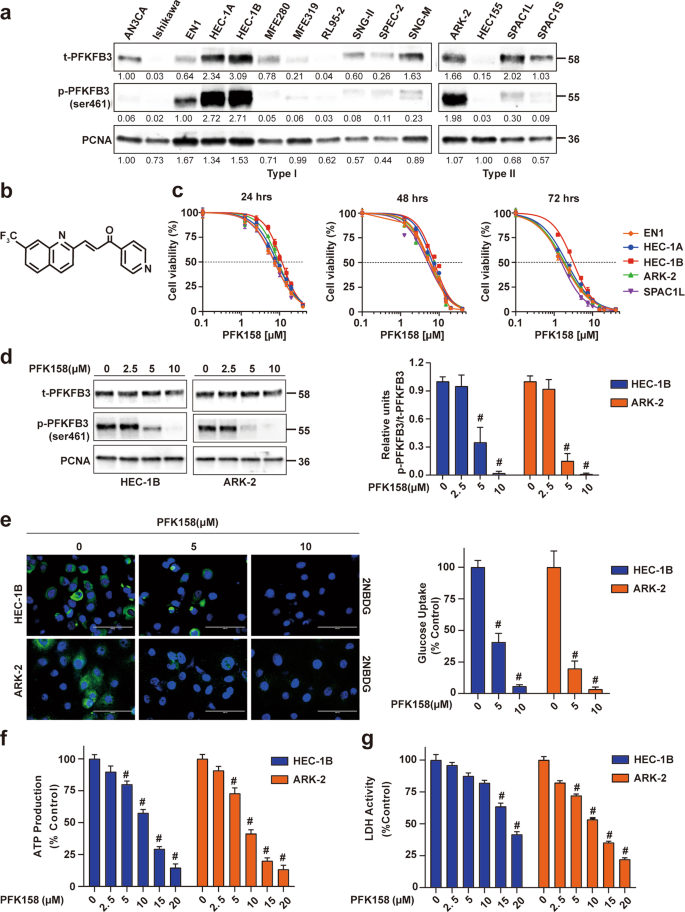Inhibition Of Pfkfb3 Induces Cell Death And Synergistically Enhances Chemosensitivity In Endometrial Cancer Oncogene