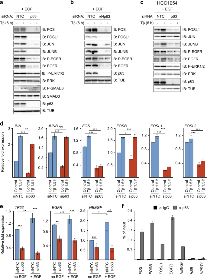 Fra-1/AP-1 induces EMT in mammary epithelial cells by modulating Zeb1/2 and  TGFβ expression