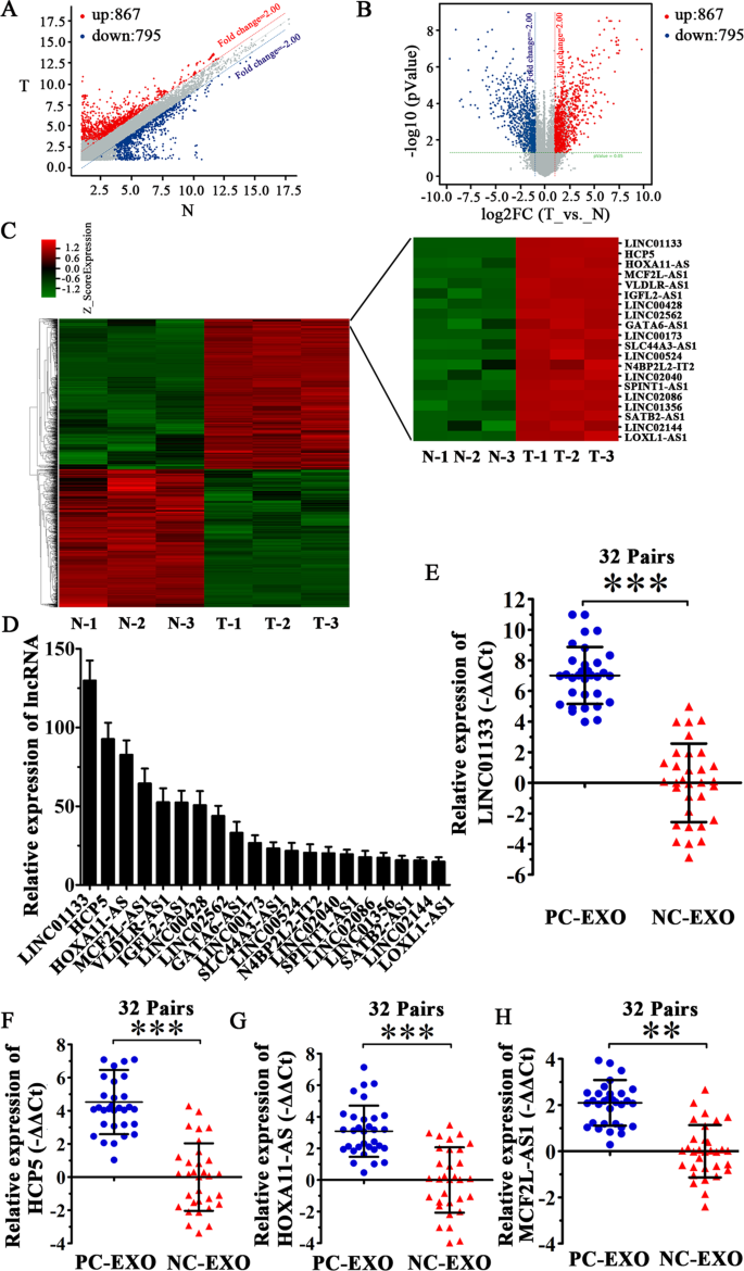 Tumor Derived Exosomal Long Noncoding Rna Linc Regulated By Periostin Contributes To Pancreatic Ductal Adenocarcinoma Epithelial Mesenchymal Transition Through The Wnt B Catenin Pathway By Silencing Axin2 Oncogene Tumor Derived Exosomal Long Noncoding Rna Linc Regulated By Periostin Contributes To Pancreatic Ductal Adenocarcinoma Epithelial Mesenchymal Transition Through The Wnt B Catenin Pathway By Silencing Axin2 Oncogene