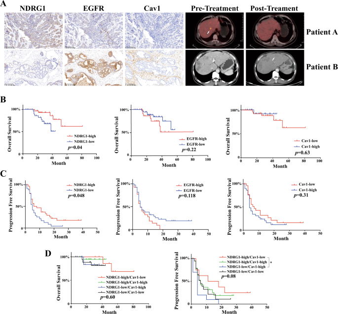 Fig. 8: Clinical significance of the NDRG1/EGFR pathway in CRC patients with CTX treatment.