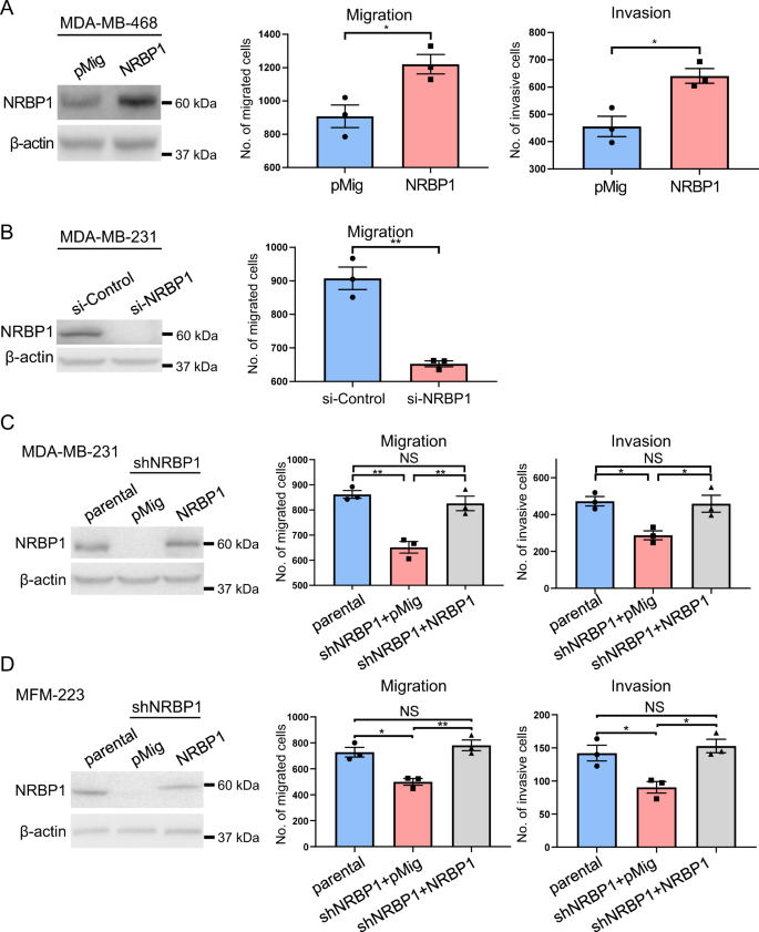 Fig. 2: NRBP1 positively regulates TNBC cell migration and invasion.