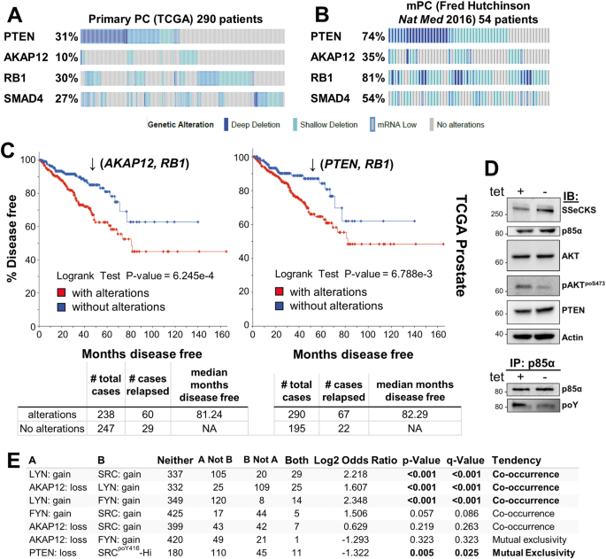 Fig. 1: Loss of PTEN, AKAP12, RB1, and SMAD4 in human primary and metastatic prostate cancer datasets.