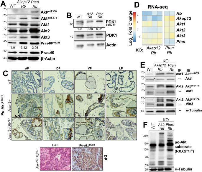 Fig. 2: AKT isoform differences in transgenic PC mouse models.
