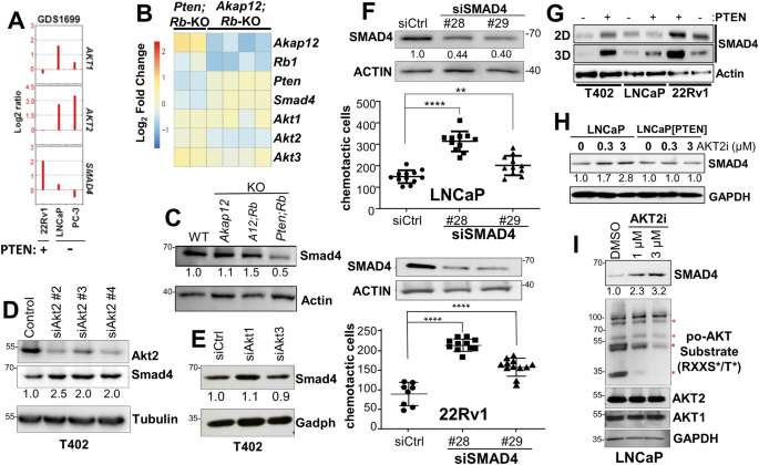 Fig. 5: Inverse relationship between AKT2 and SMAD4 expression.